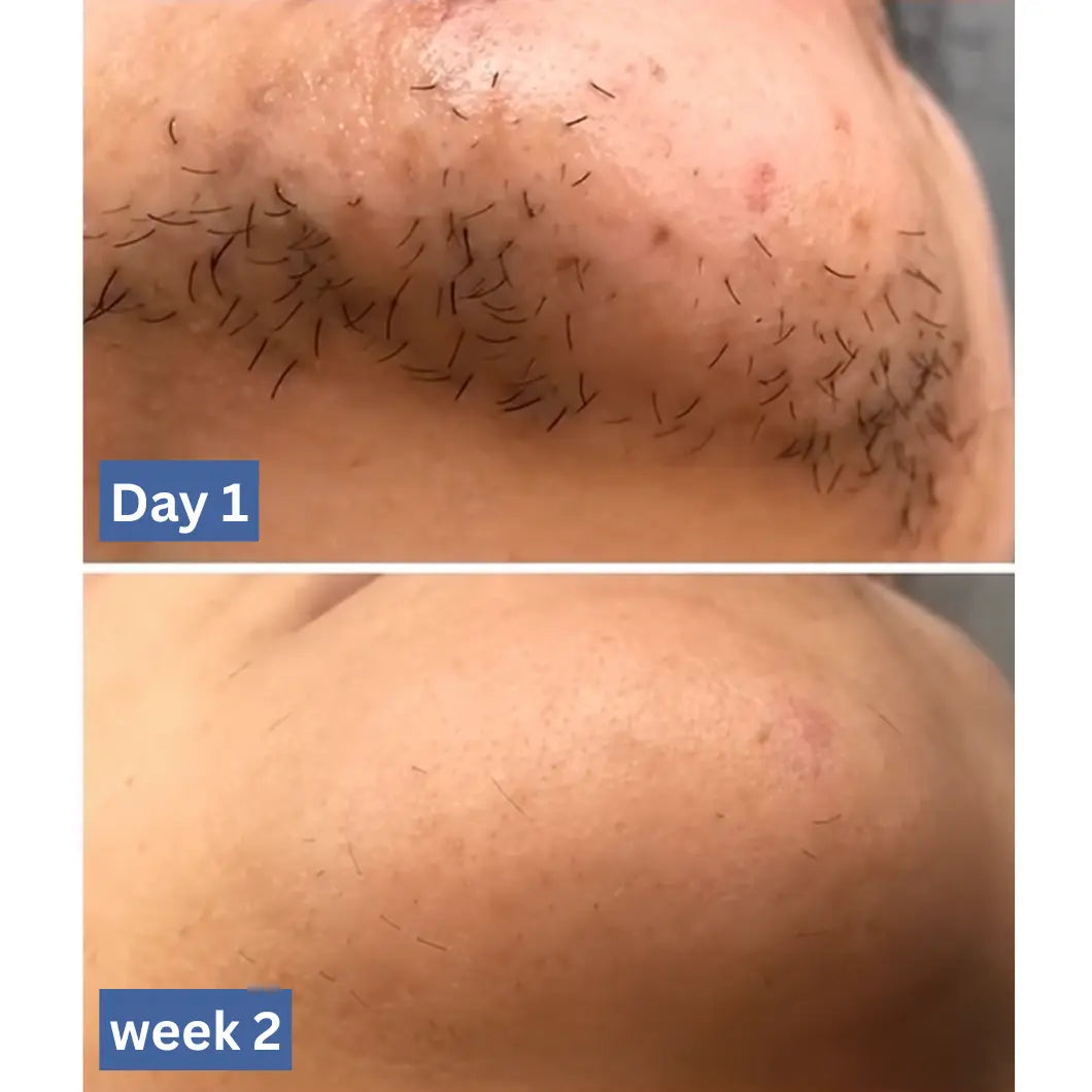 Cyperlux 2.0 — Cyperus rotundus oil