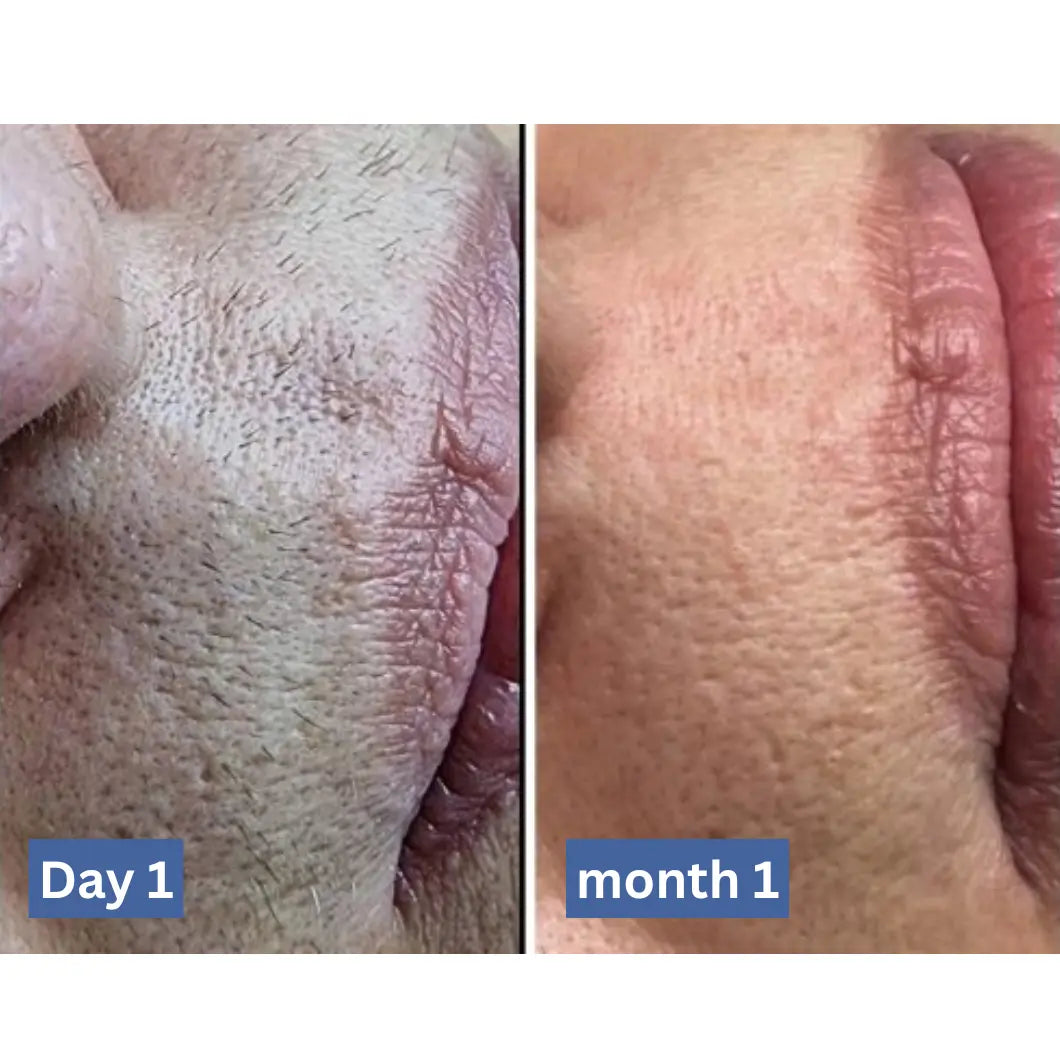 Cyperlux 2.0 — Cyperus rotundus oil
